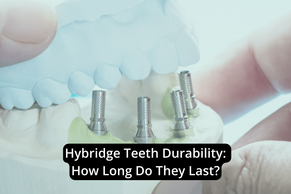 Hybridge Teeth Durability How Long Do They Last? North Austin